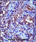 CRYAB Antibody (Center)